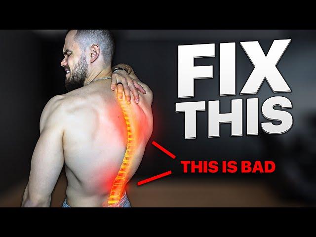 FIX your BROKEN POSTURE in Just 10 Min/Day.