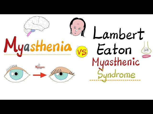 Myasthenia Gravis (MG) vs. Lambert-Eaton Myasthenic Syndrome (LEMS) - Neurology