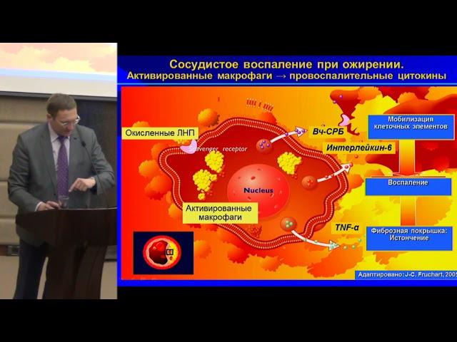 Сусеков А.В., Кардиометаболические риски у пациентов с сахарным диабетом 2 типа. ..