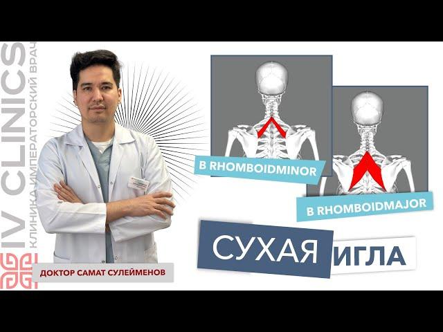 Сухая игла. RHOMBOID MAJOR. RHOMBOID MINOR. Большая и малая ромбовидные мышцы. Постановка игл.