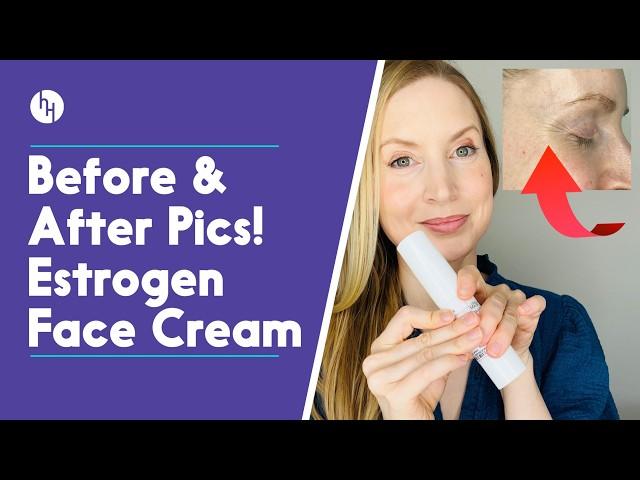 See My Skin After 3 Months Of Estrogen Face Cream (Alloy M4 Review)