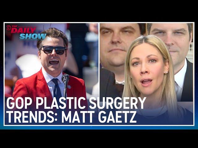 Desi Breaks Down Matt Gaetz's Plastic Surgery | The Daily Show