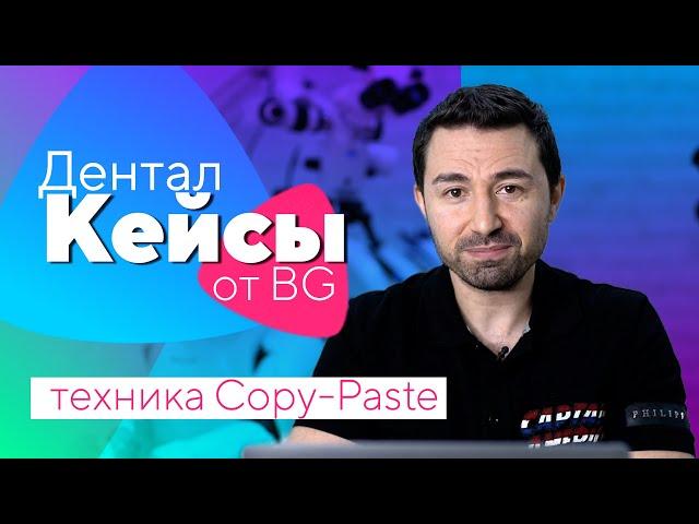 Дентал Кейсы от BG. Эстетическая реабилитация в технике Copy-Paste. #01