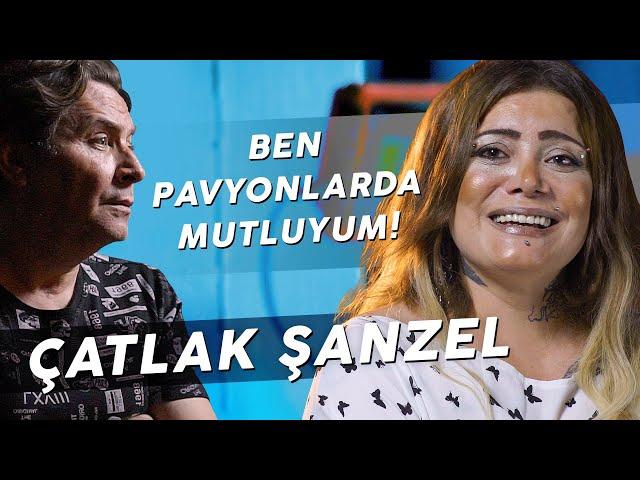 ÇATLAK ŞANZEL' İN AKILALMAZ HAYAT HİKÂYESİ