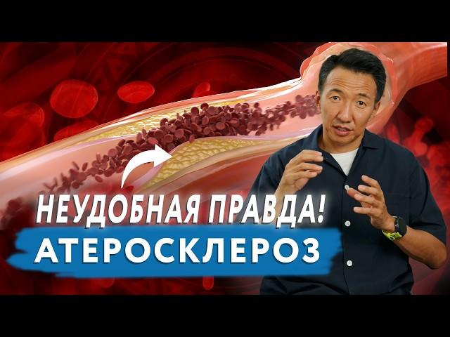 Правда об АТЕРОСКЛЕРОЗЕ, которую редко говорят! // ХОЛЕСТЕРИНОВЫЕ БЛЯШКИ // #чжудши