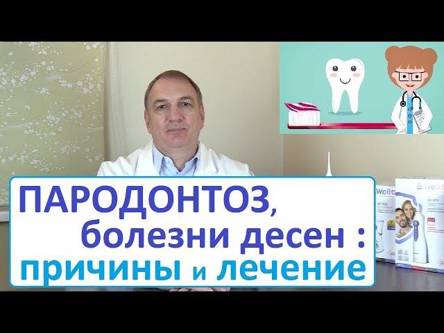 ПАРОДОНТОЗ, кровоточивость десен – как лечить. Причины болезней полости рта - неизвестные факты.