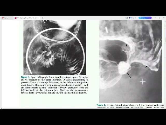 GIT IMAGING THE TEACHING FILES SERIES