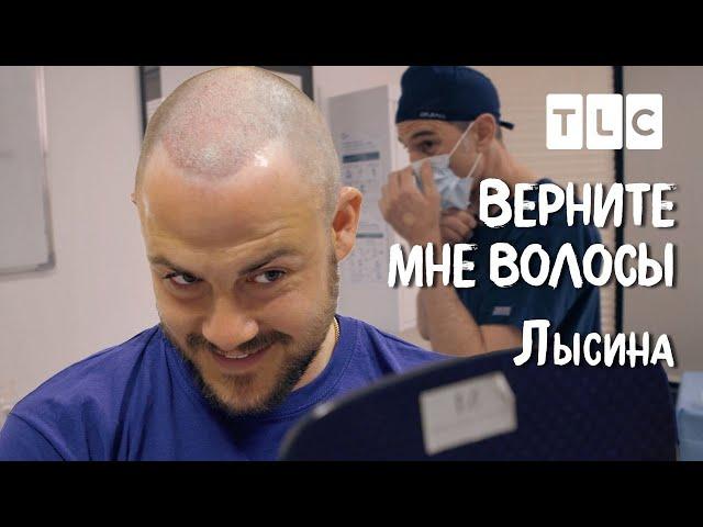 Лысина | Верните мне волосы | TLC