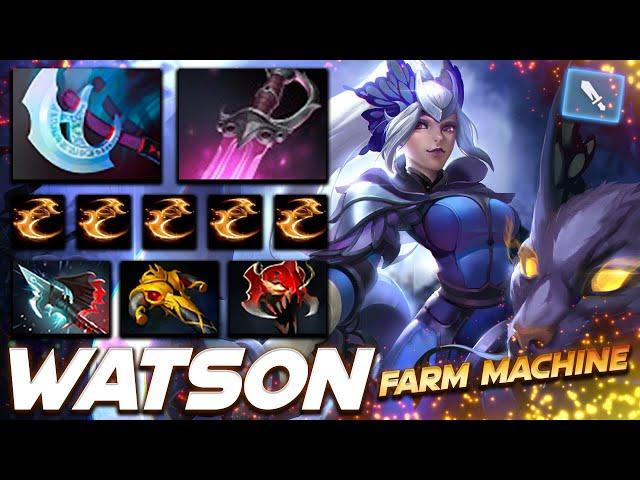 Watson Luna Farm Machine - Dota 2 Pro Gameplay [Watch & Learn]