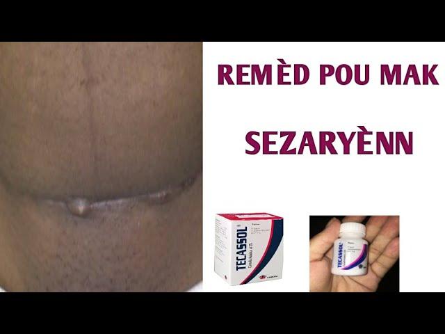 REMÈD POU SIKATRIS SEZARYÈNN