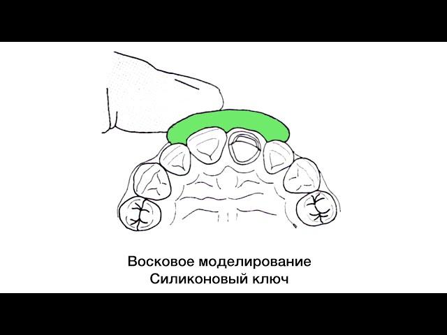 Силиконовый ключ