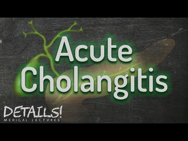 Acute Cholangitis | Tokyo Guidelines 2013 | Details