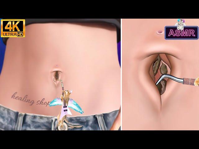 [ASMR] Cool and clean! Belly stone removal, belly button removal animation asmr/4k/