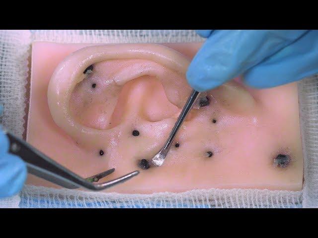 Asmr taking off blackheads | Dermatological visit | ASMR Spanish | Asmr with Sasha