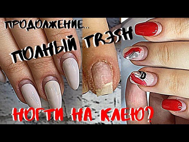 ТРЕШ МАНИКЮР Продолжение истории|НОГТИ НА КЛЕЮ??? | ТАК НЕЛЬЗЯ  ПИЛИТЬ| Преображение ногтей