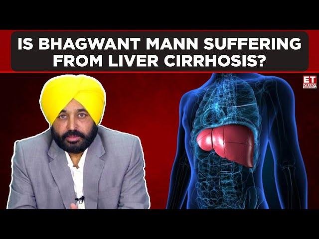 Is Punjab CM Bhagwant Mann Suffering From Liver Cirrhosis? | ET Now | Latest News | Breaking News