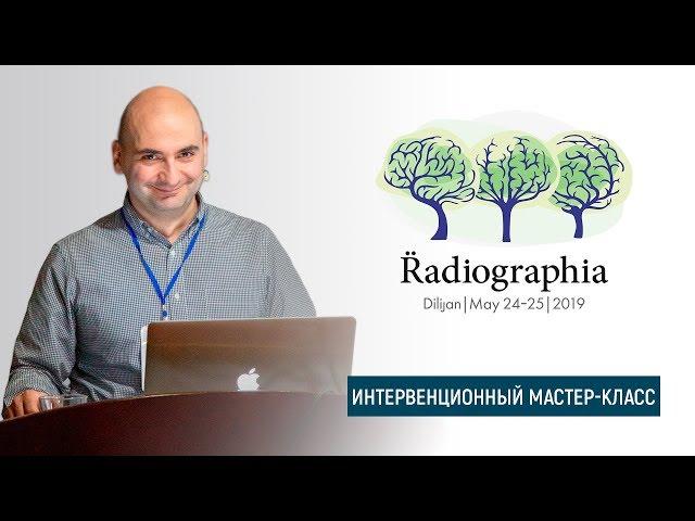 Гамлет Мкртчян. Пункционная биопсия образований легкого под  контролем КТ