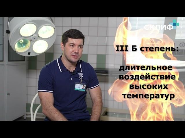 Как лечить ожоги? Как считают площадь ожогов на теле? Кто такой комбустиолог?