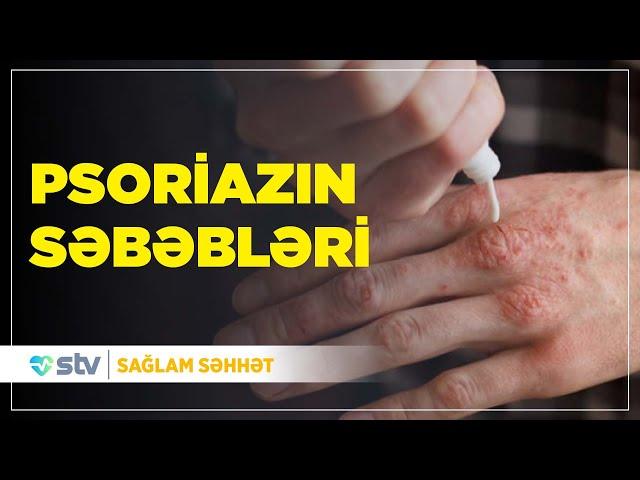 Psoriaz nədir? / Psoriazın səbəbləri / Psoriazın Müalicəsi