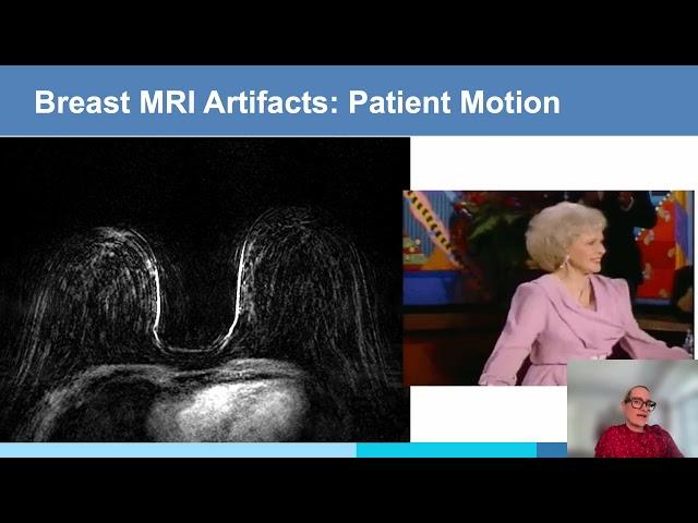 ISMRM MR Academy: Artifacts in Breast MRI