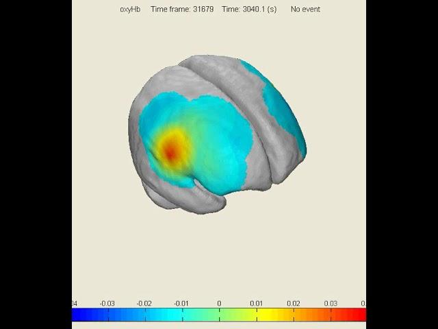 Using Light to Monitor Brain Activity - Dr. Nasser Kashou