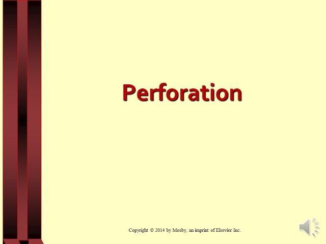 Lecture on Perforation