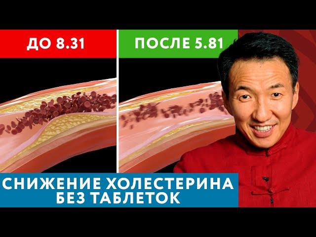 HOW TO REDUCE CHOLESTEROL WITHOUT PILLS? It's possible! // #zhudshi #Tibetanmedicine #cholesterol