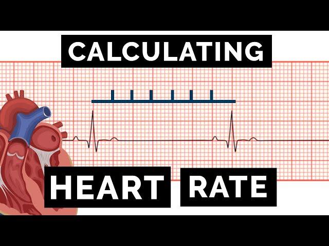 Calculating Heart Rate on an ECG | EKG | OSCE Guide | UKMLA | CPSA | PLAB 2