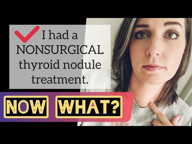 NONSURGICAL alternative to thyroidectomy: My experience with Thyroid RFA (July 2019)