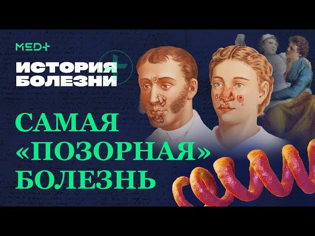 Сифилис. Первые признаки заражения, диагностика и лечение | История болезни