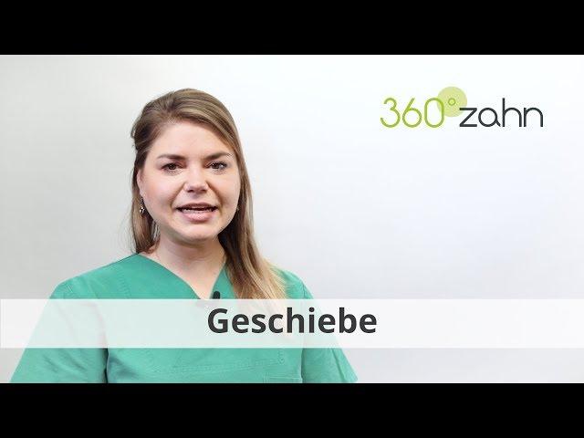 Geschiebe - Was ist ein Geschiebe? | Dental-Lexikon | 360°zahn