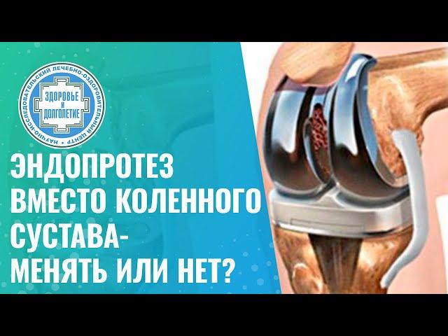  Эндопротез коленного сустава - менять или нет?