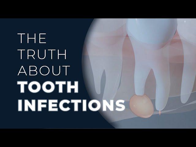 The Truth About Tooth Infections