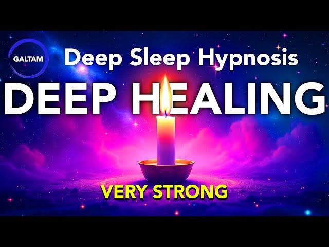 Deep Sleep Hypnosis  (Activate Self Healing) VERY STRONG!! Trance & Inner Cleansing