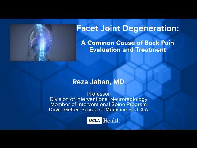 Facet Joint Degeneration: A Common Cause of Back Pain Evaluation and Treatment