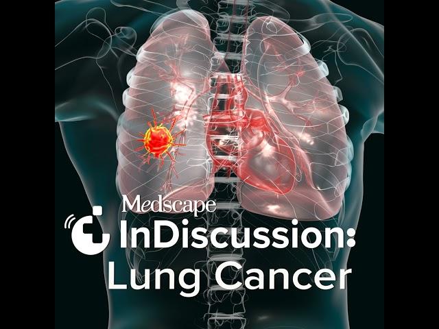 S1 Episode 4: Managing Lung Cancer With Neoadjuvant and Adjuvant Therapy