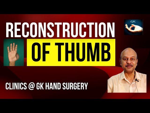 Clinics @ GK Hand Surgery: Discussion on 'Reconstruction of thumb' - Evaluation & plan of management