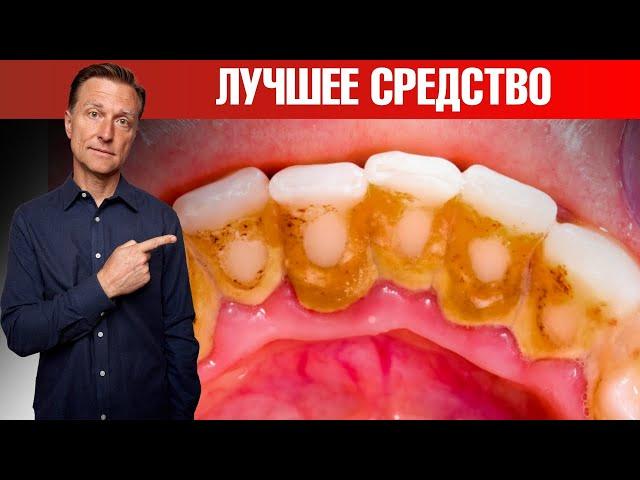 Зубной налет и зубной камень? Лучшее средство! Сделайте сами