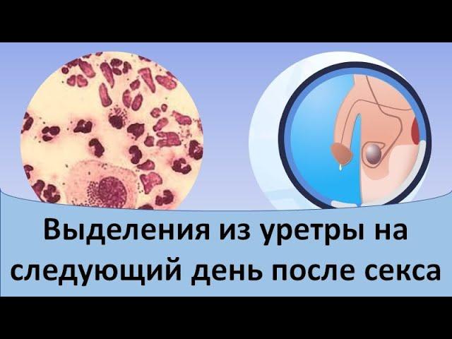 Выделения из уретры на следующий день после секса.