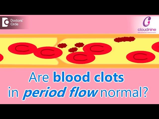 Why does menstrual bleeding have blood clots? Is it normal?-Dr.Shalini Varma of Cloudnine Hospitals