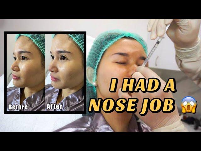 I HAD A NOSE JOB | Jen Barangan