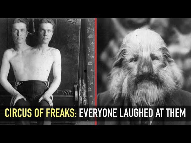 Circus freaks: stories and tragedies of circus freaks