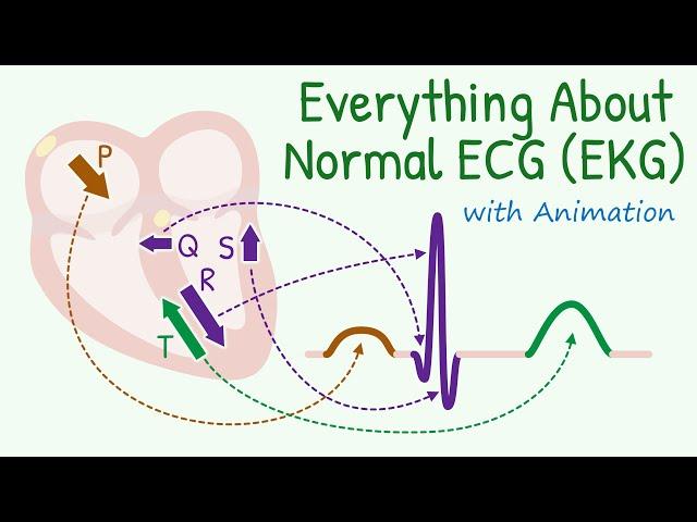 From Basics of 12 Lead ECG to How Waves are Produced: Everything about Normal Electrocardiogram