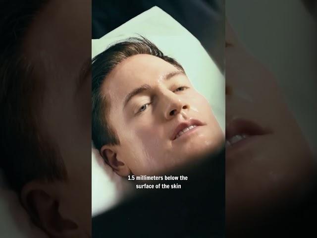 Trying Sofwave for skin rejuvenation with Project Babyface. No needles, no downtime.