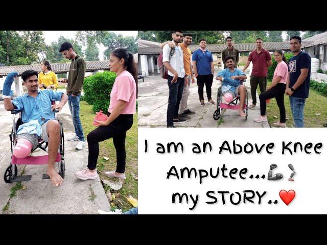 Above Knee Amputee || My story || Prosthetics || #ottobock #disability #prostheticleg #vlog #amv