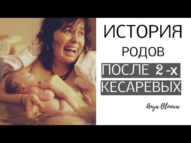 ЕСТЕСТВЕННЫЕ РОДЫ ПОСЛЕ ДВУХ КЕСАРЕВЫХ СЕЧЕНИЙ