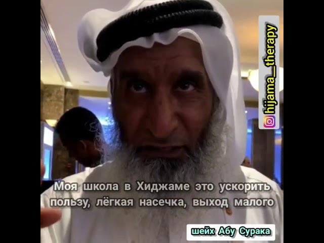 Хиджама. Ошибки многих хаджамов