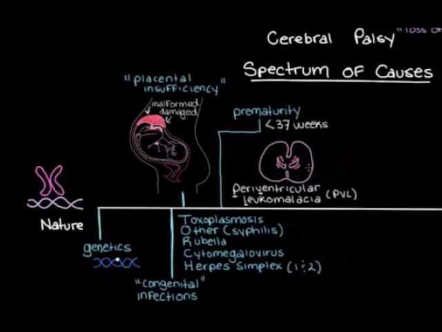 Khan Academy - What is Cerebral Palsy & What Causes it?