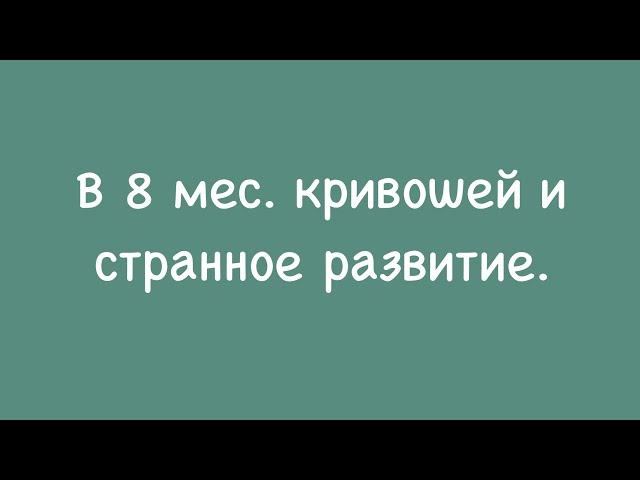 Кривошея и странности в развитии. 8 мес