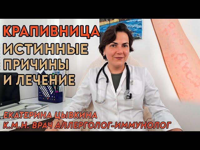 Крапивница, настоящие причины и лечение. Врач аллерголог иммунолог Екатерина Цывкина.